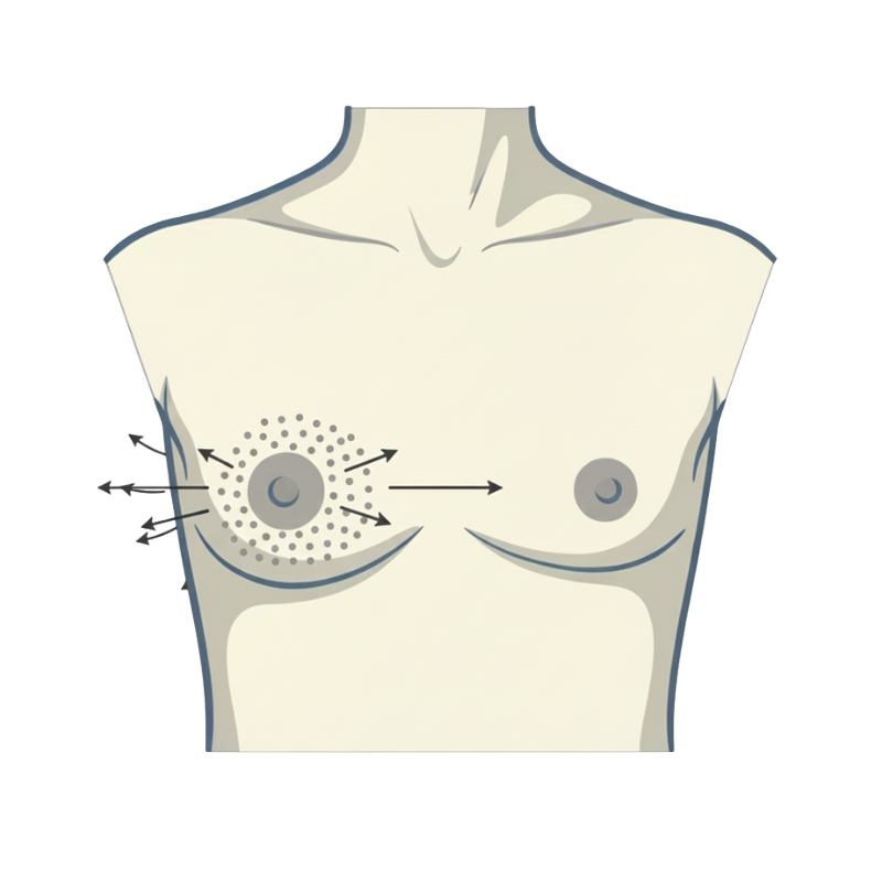 Brustaufbau mit Eigenfett