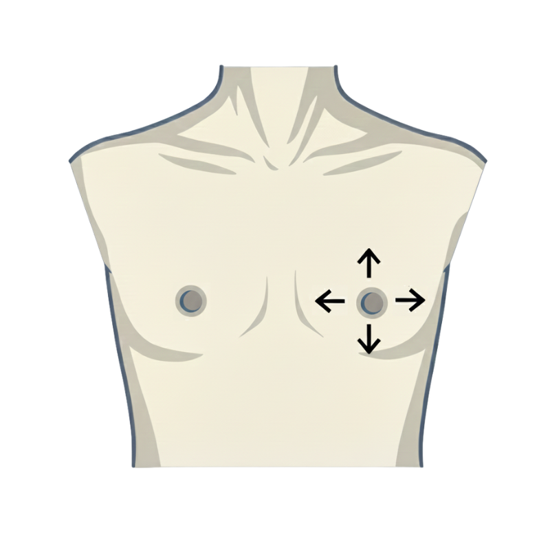 Individuelle Brustwarzen-Platzierung