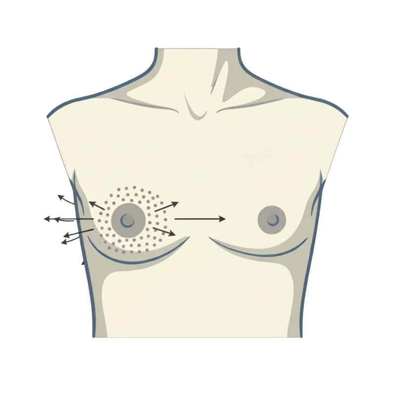 Brustaufbau mit Eigenfett
