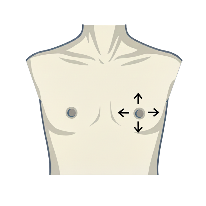Individuelle Brustwarzen-Platzierung